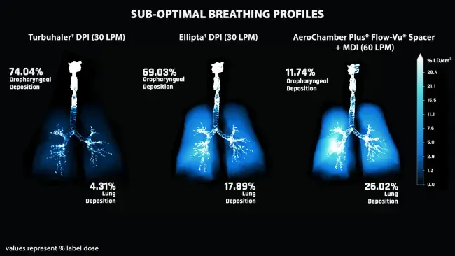 sub optimal breathing profile