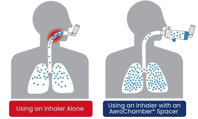 Without AeroChamber