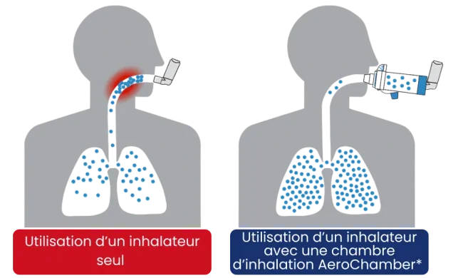 Without AeroChamber