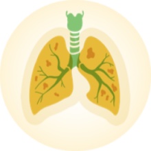 Vivre avec la Fibrose Kystique